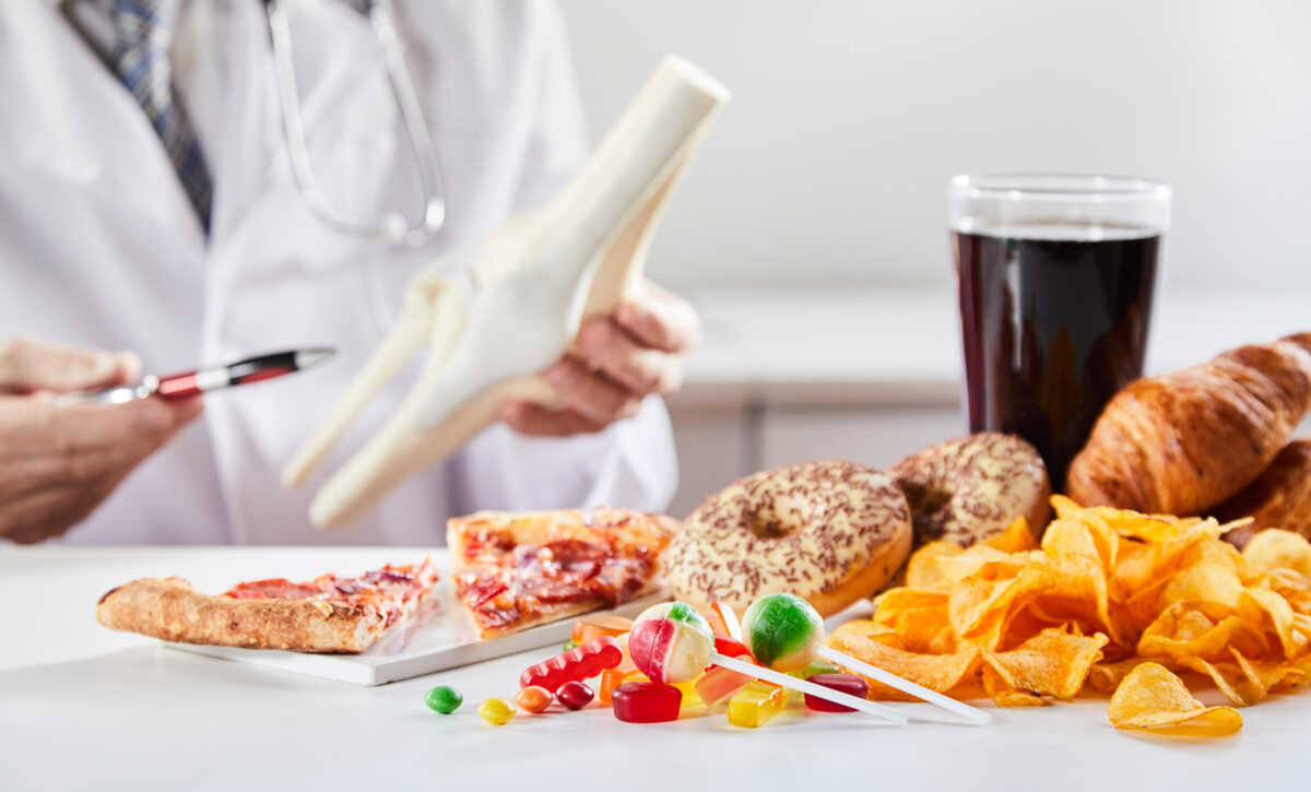 The 7 Worst Foods for Your Teeth,And Why They’re Causing Cavities 1 Doctor holding white model of bone for showing link between bad unhealthy food and bone disease