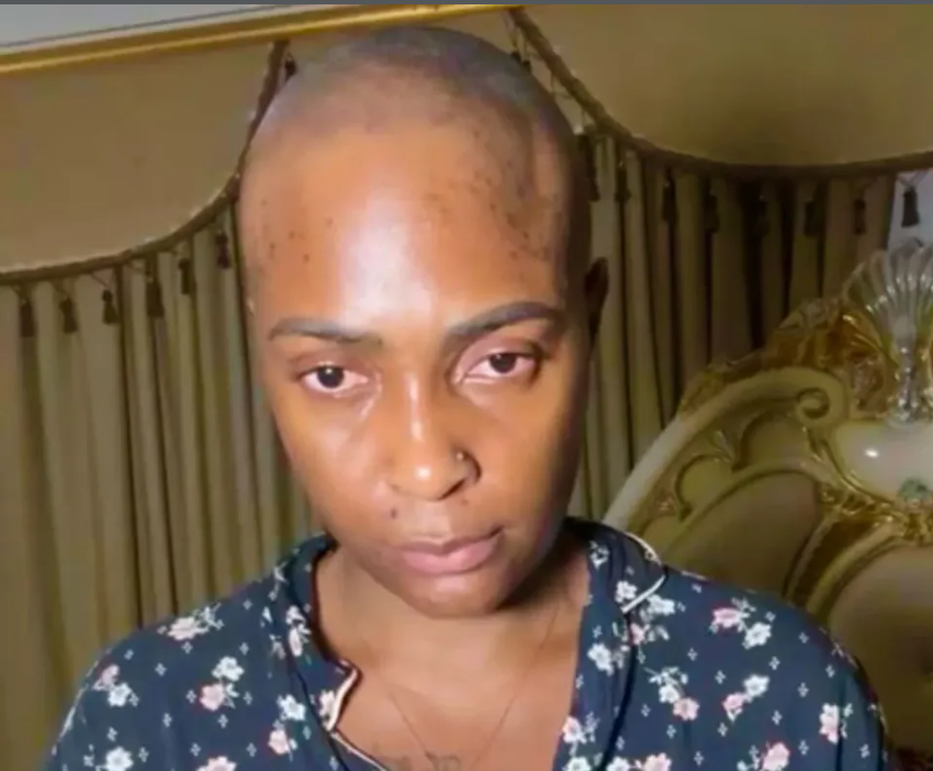 This Nigerian Popular Influencer’s Stage 4 Cancer Claim Sparked Donations, Then a National Uproar 1 Blessing CEO