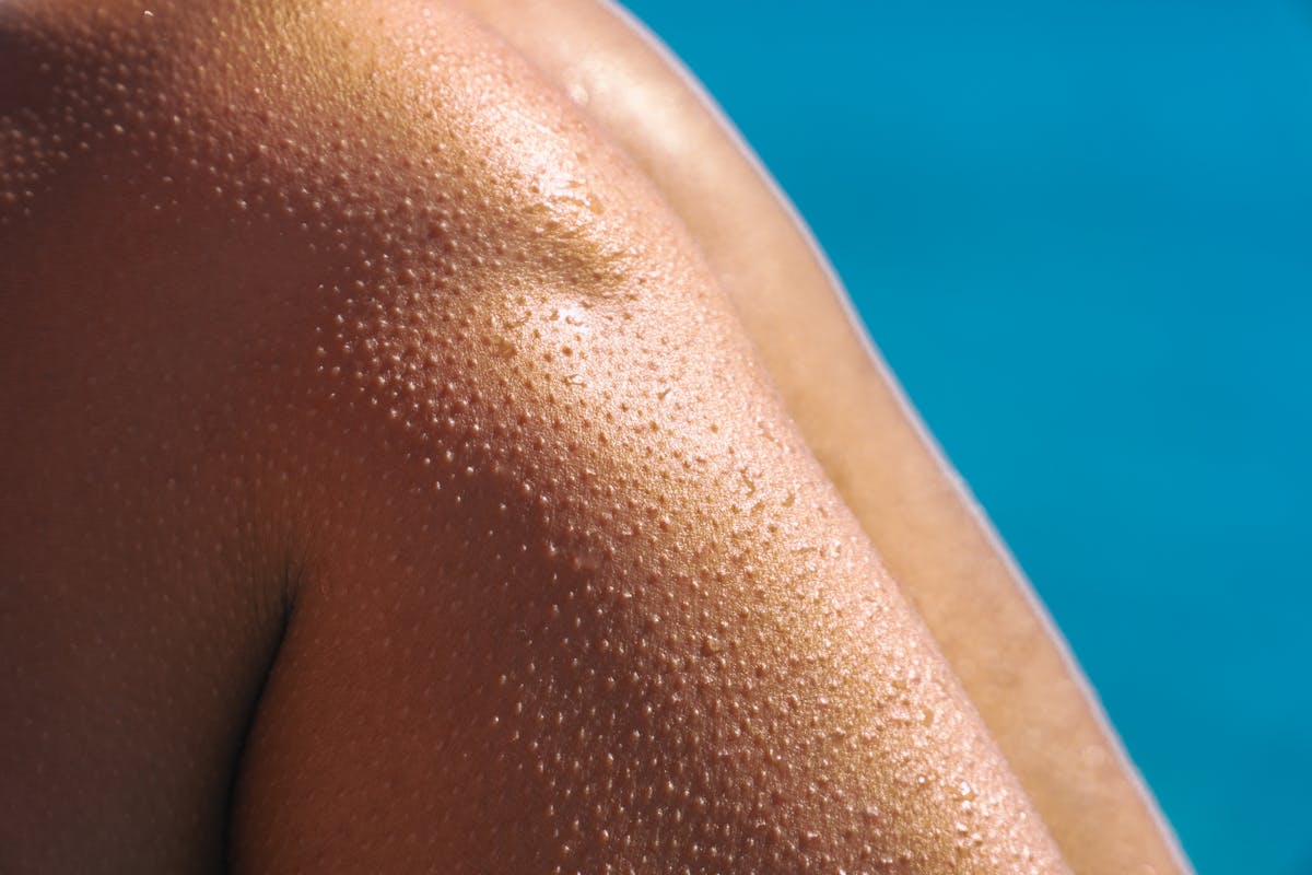 10 Unusual Signs Your Body Is Healthier Than You Think 3 Detailed shot of goosebumps on a tanned shoulder next to a pool, perfect for summer concepts.