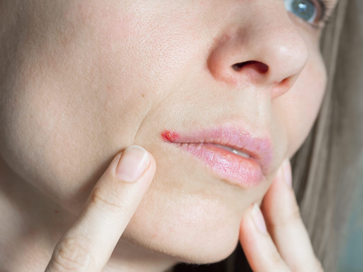 7 Bowel Cancer Warning Signs That May Show Up in Your Mouth, According to Dentists 2 181509924 m