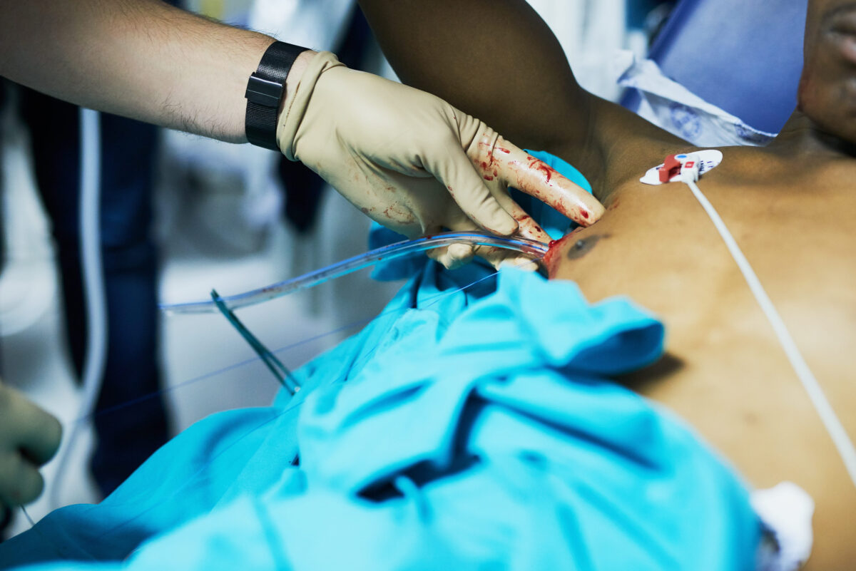 Restoring respiratory function with chest drainage. Cropped shot of a doctor inserting a tube into a patients chest in an emergency room.