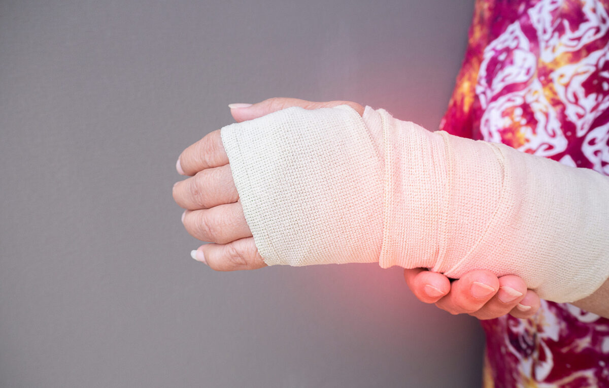 Broken arm concept. Cast broken arm for immobilize after arm and hand injury. Broken wrist and arm with bandage. Hand wrapped in bandage. Orthopedic.