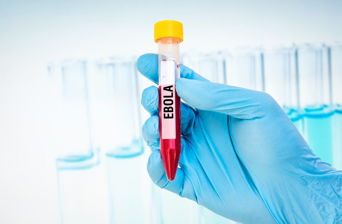 Scientists hand holding a test-tube with blood sample for EBOLA test