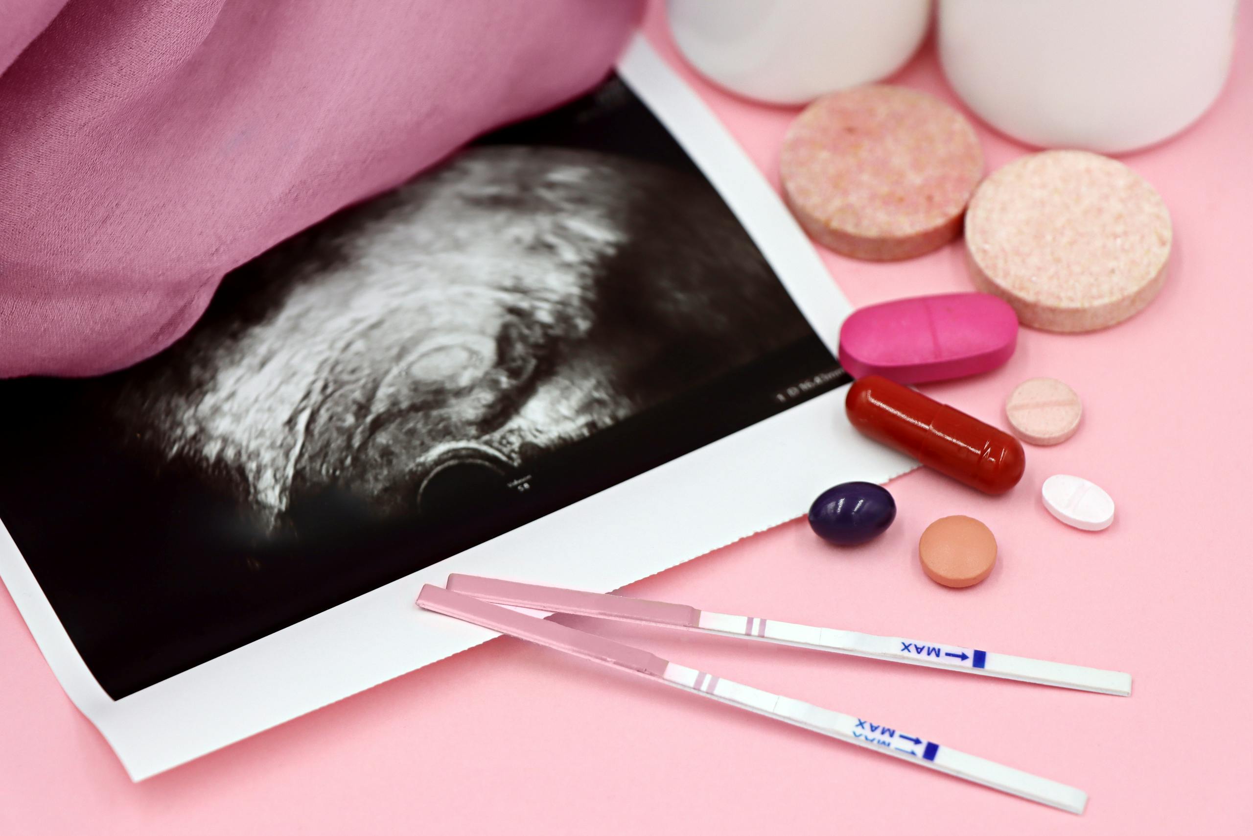 7 Uncomfortable Reasons More Women Are Saying No to Motherhood 3 A closeup of pregnancy tests and an ultrasound with supplements on a pink background.
