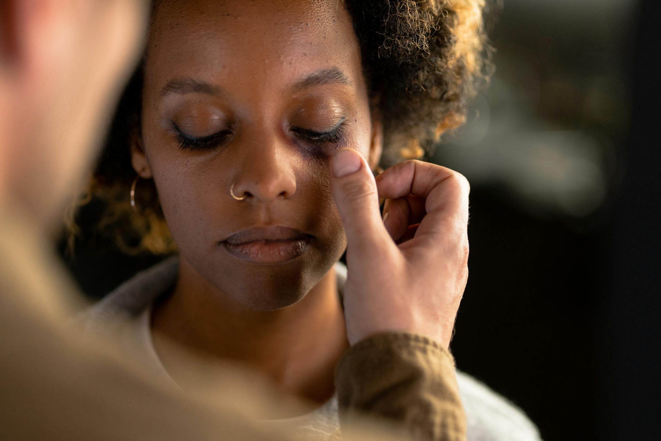 A person gently touches a woman's face with a visible bruise under her eye, showing concern.