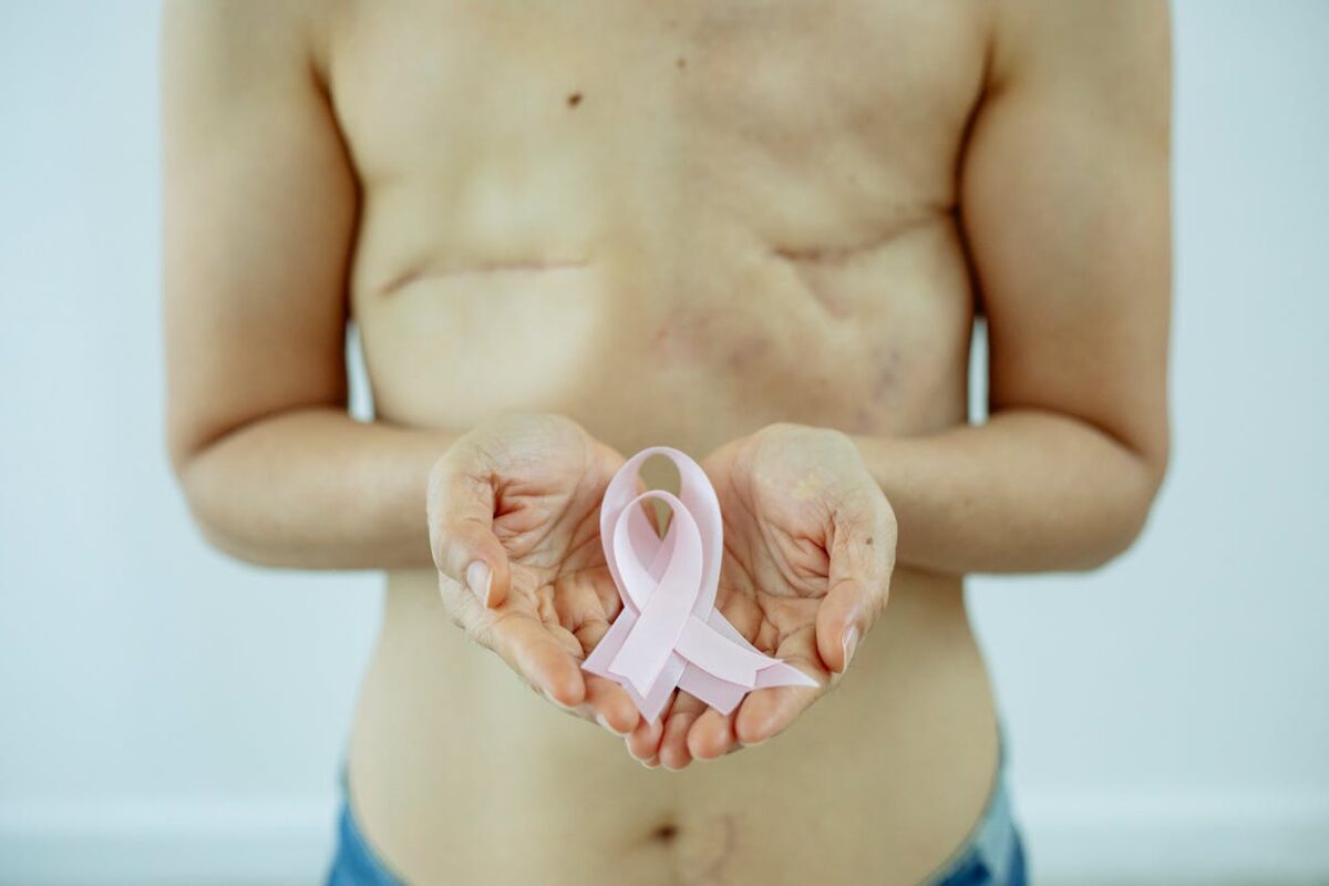 shirtless-woman-with-scars-after-cancer-showing-pink-ribbon-in-hands-