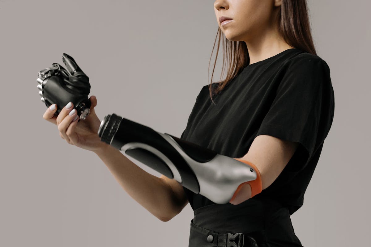 Young woman with a modern prosthetic arm showcasing advanced technology.