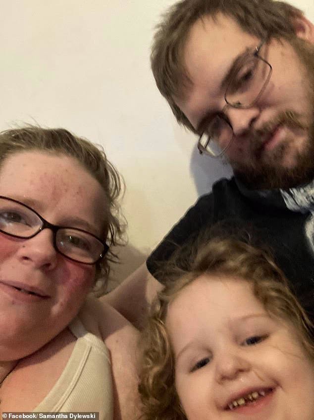 New York Parents Sentenced After 3 Year Old Joycelynn Dylewski Died From Chronic Neglect, Severe Lice Infestation, And Lack Of Medical Care 1 2 daily mail