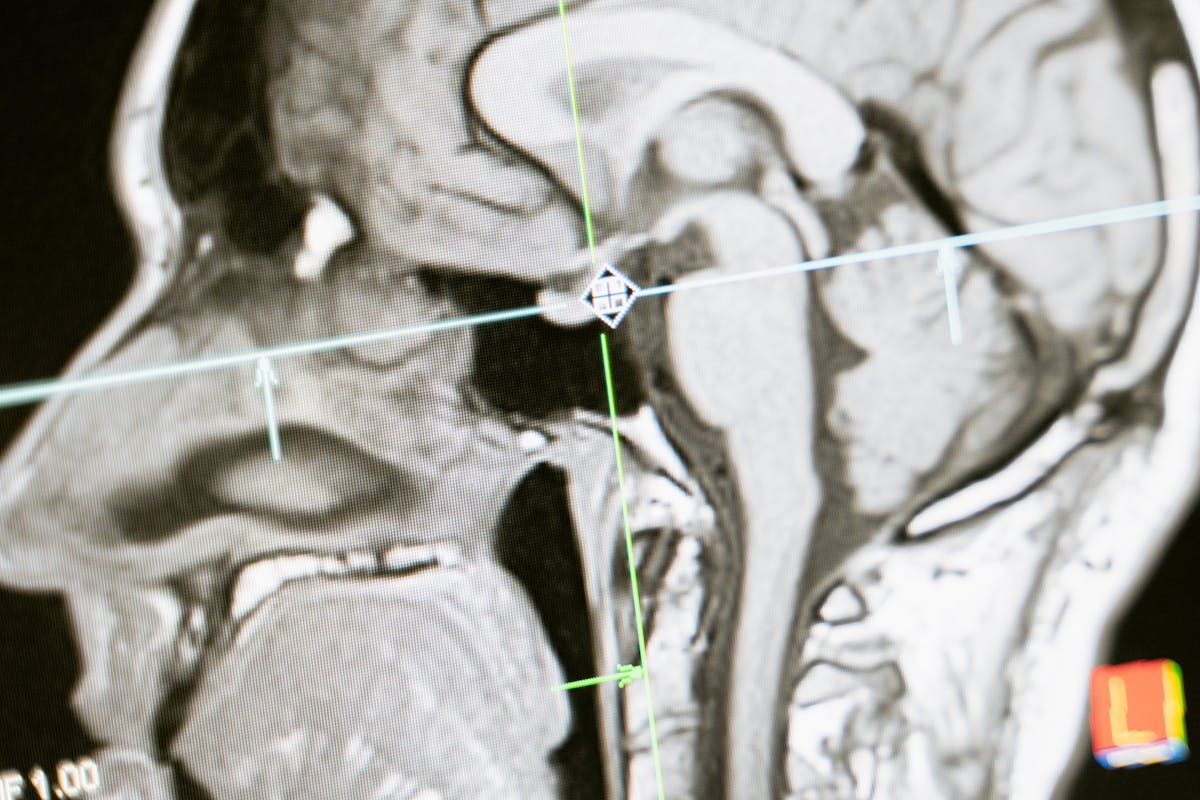 Scientists Found Something Creepy Your Brain Does Under Anesthesia 1 Close-up of an MRI scan showing a sagittal view of the human brain for analysis.
