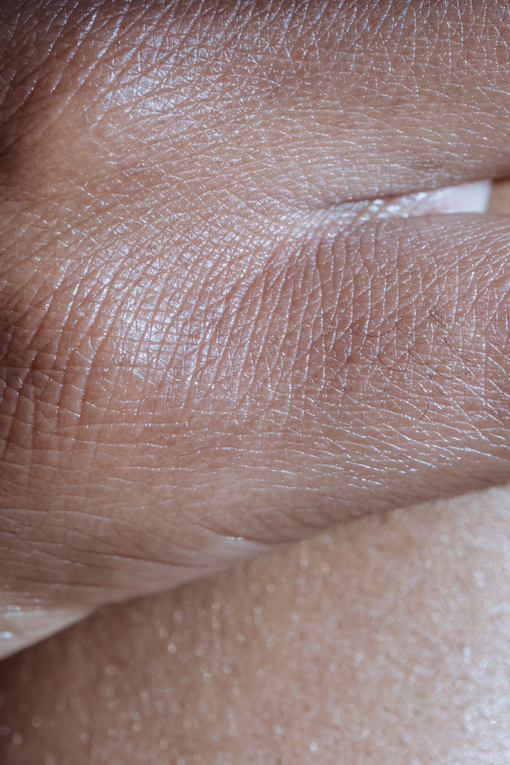 10 Quiet Kidney Disease Signs Too Many People Ignore Until It Gets Serious 2 Detailed close-up photo highlighting the texture and smoothness of human skin with visible wrinkles.