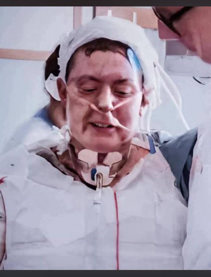 Swedish Mother Emma Schols Ran Into A Burning House To Save Her Six Children And Survived A 93% Burn Injury. 2 WhatsApp Image 2026 07 18 at 12.07.48 PM